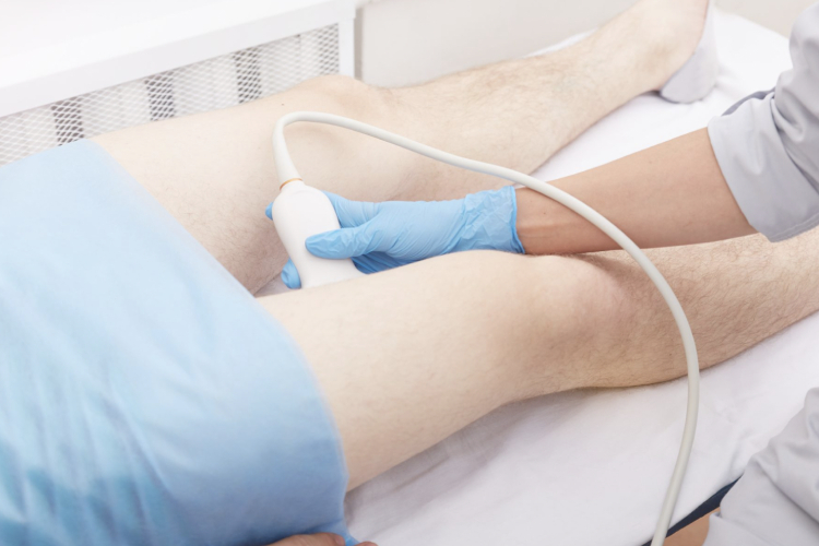 Ultrasonido Especializado Doppler Vascular